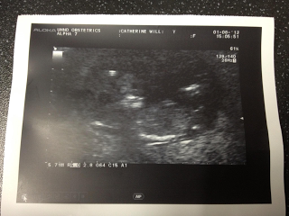 So …. we’re having a baby!!!